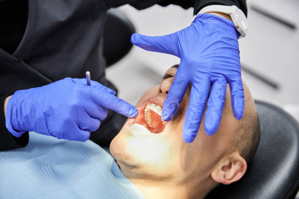 Best Emergency Wisdom Tooth Extraction in Trucksville, PA